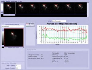 Magen-Funktionsszintigraphie