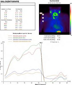Speicheldrüsenszintigraphie