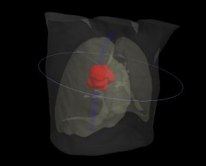 3D Darstellung der Behandlungsregion und Technik