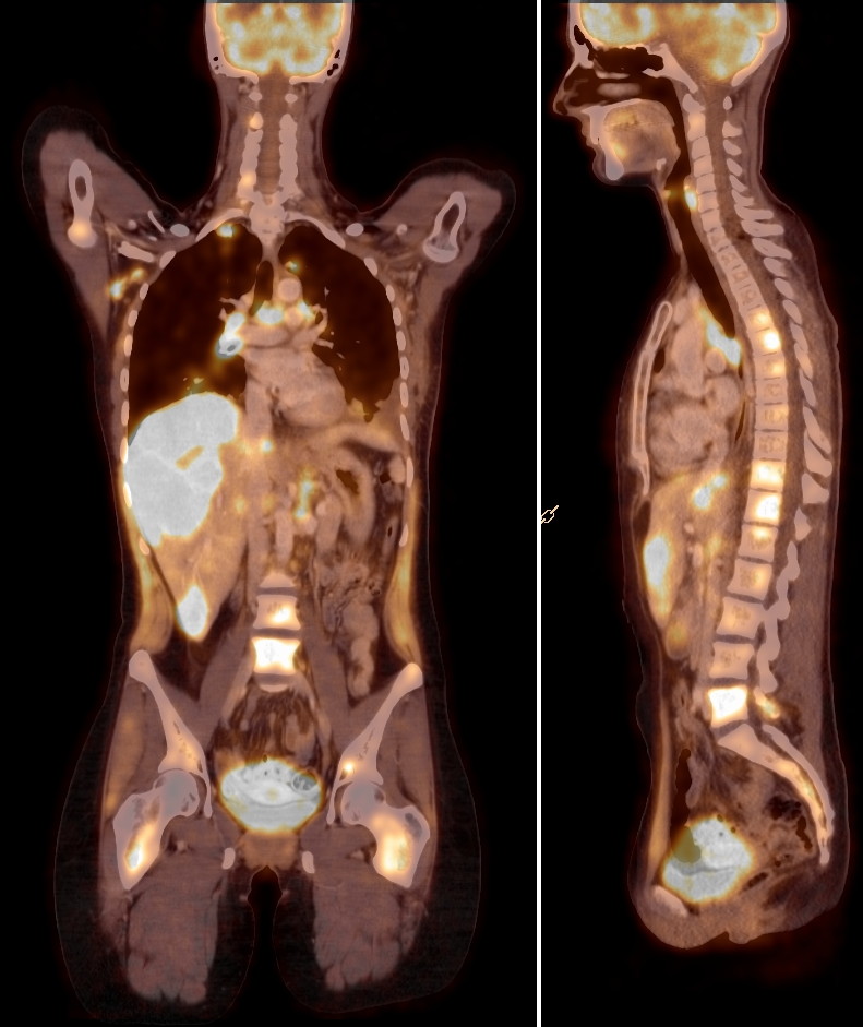 PET-CT - Klinik Dr. Hancken